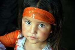 אהבה ממבט ראשון בלדאק